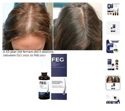 FEG Hair Growth Spray/بخاخ نمو الشعر FEG
